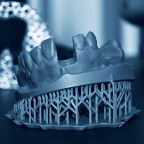 Human lower jaw printed on 3d printer of photopolymer. Stereolithography 3D printer of liquid photopolymerization under UV light. Progressive additive technology. Concept of 4.0 industrial revolution